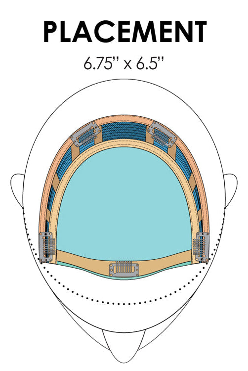 Top Crown by Jon Renau - placement